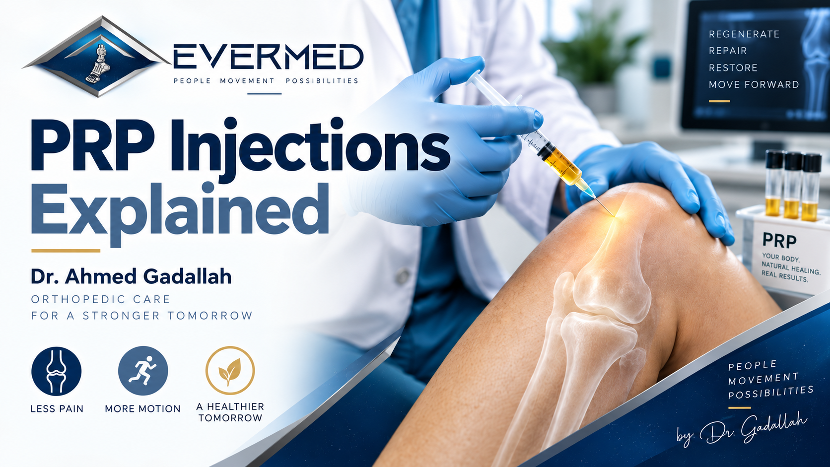 PRP injections explained by Dr. Ahmed Gadallah